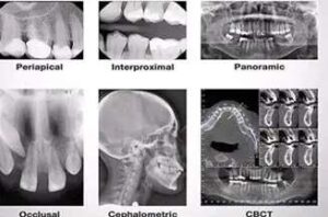 Dental Radiography for DCP’s